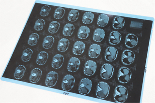 M41A 医用打印胶片（激光）