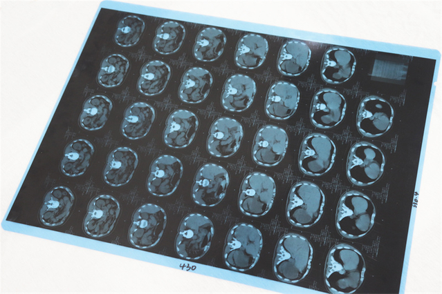 M41A 医用打印胶片（激光）