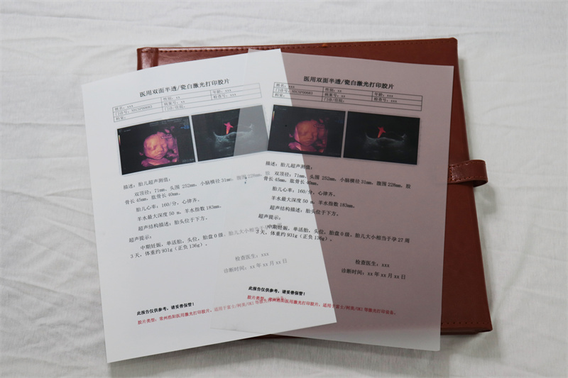 M41B 瓷白激光（双面）-B超片