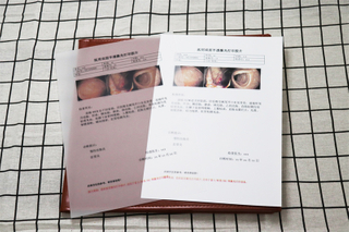 M41B 瓷白激光（双面）-B超片