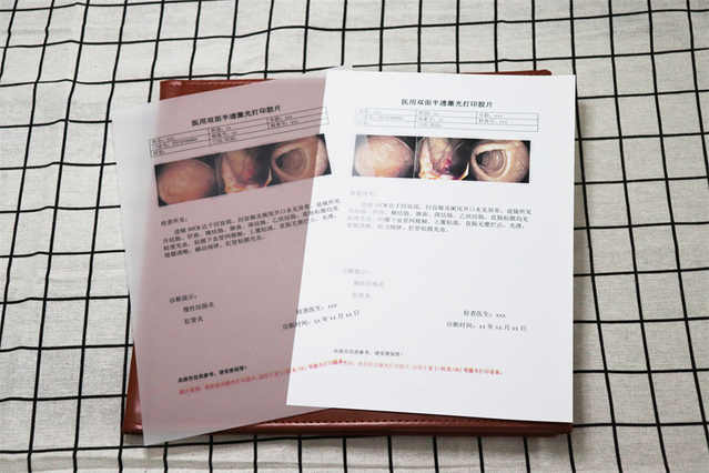 M41B 瓷白激光（双面）-B超片